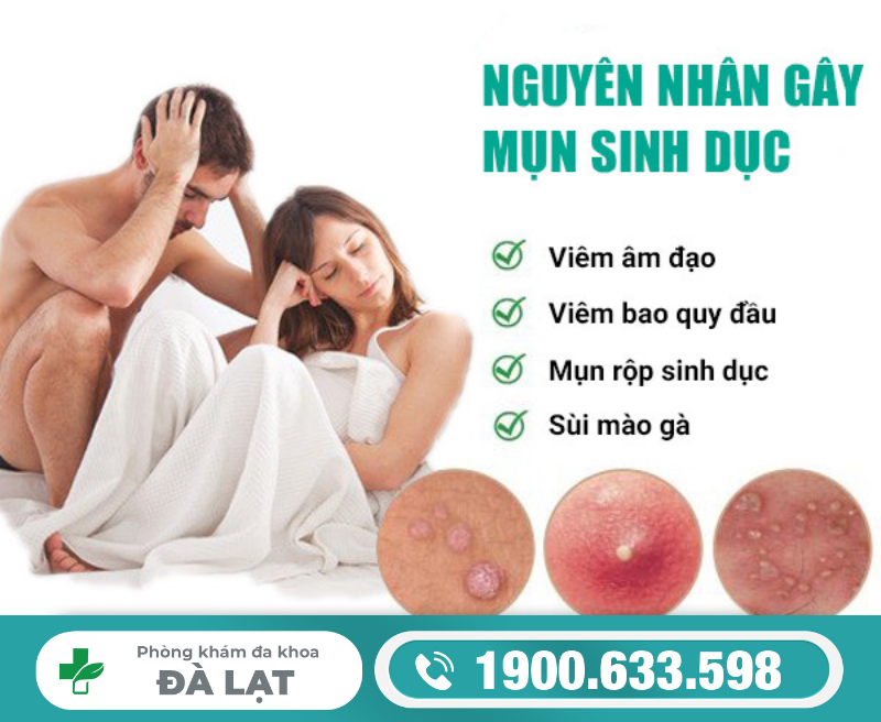Hình ảnh minh họa